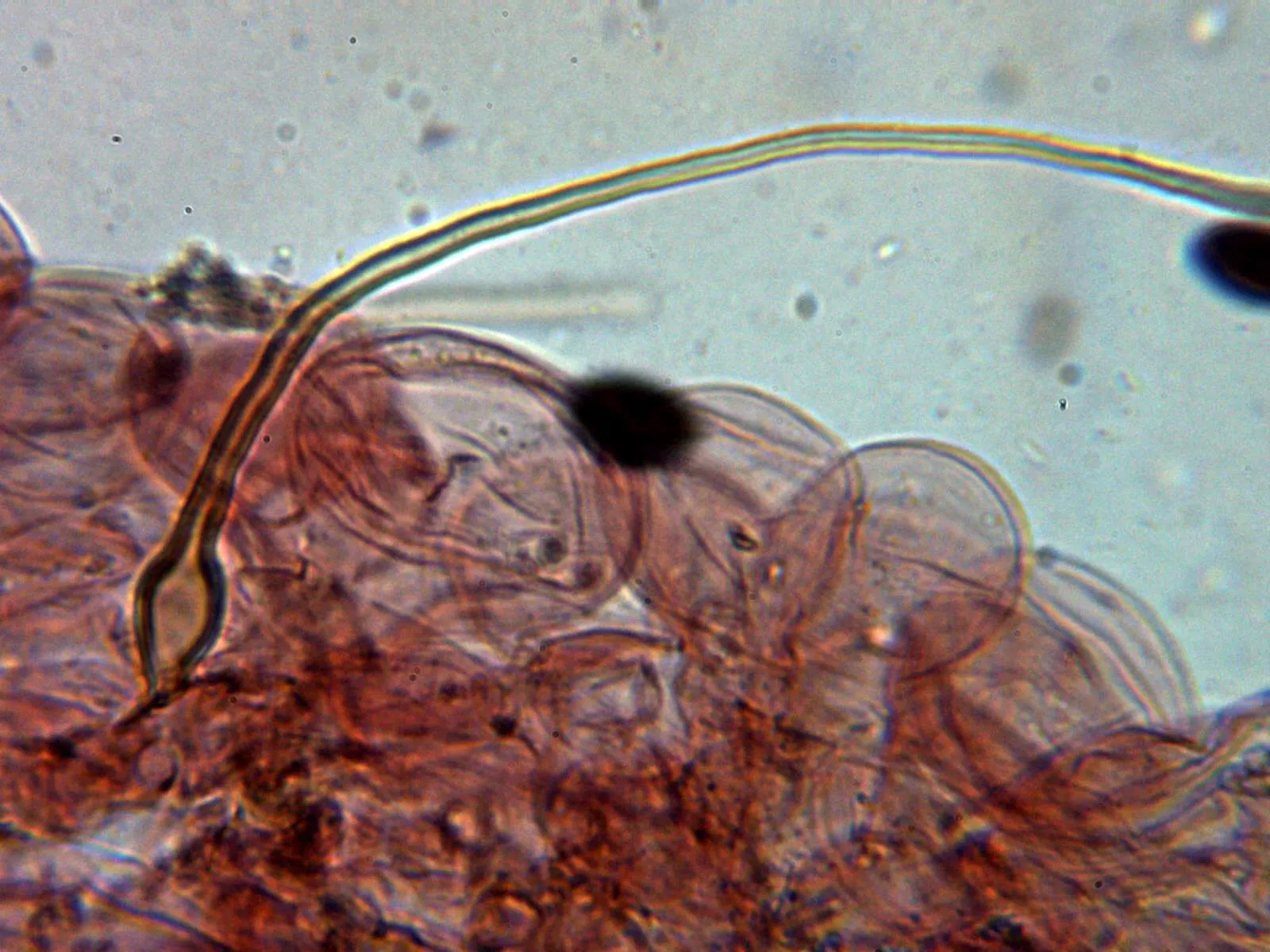 Microscopía de Parasola auricoma - 10 - Pileipellis 2